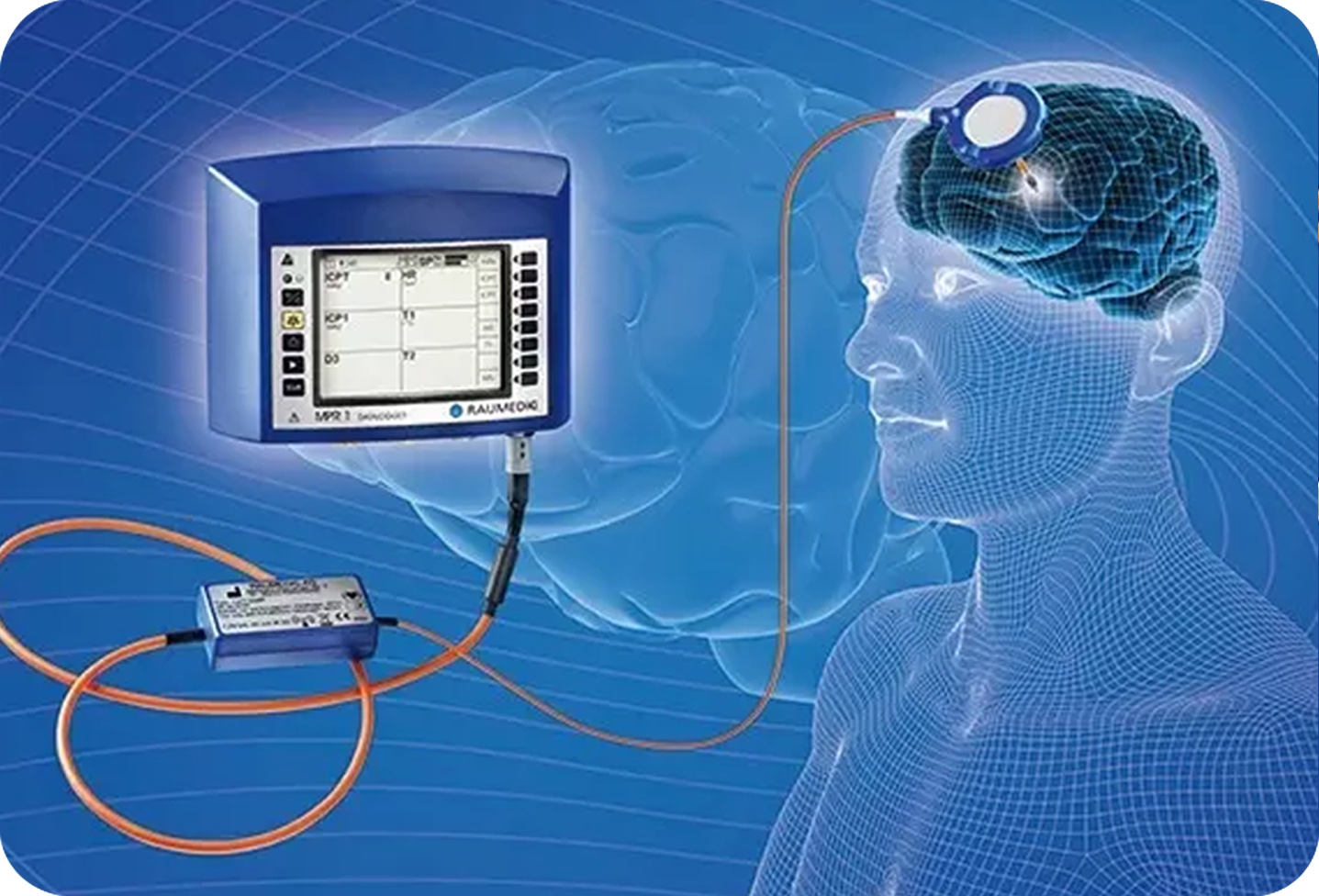 ICP & Multi Modality Neuromonitoring Raumedic Delta Surgical
